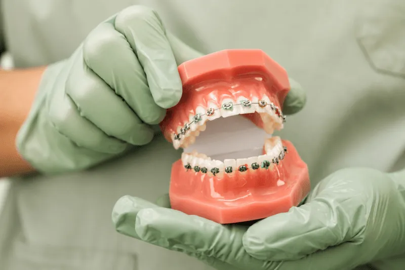 Braces Cleaning