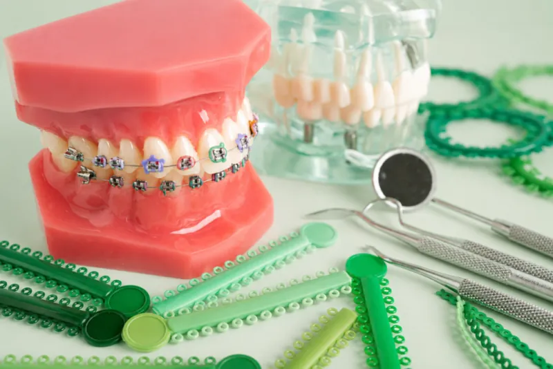 Braces Types