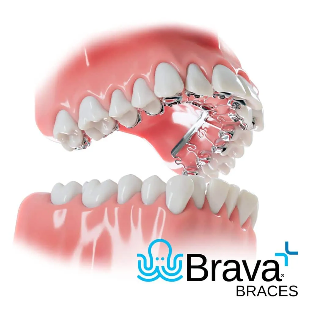 Brava Braces