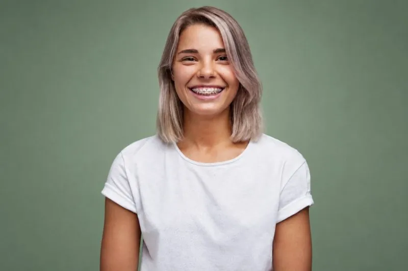 Braces Smile