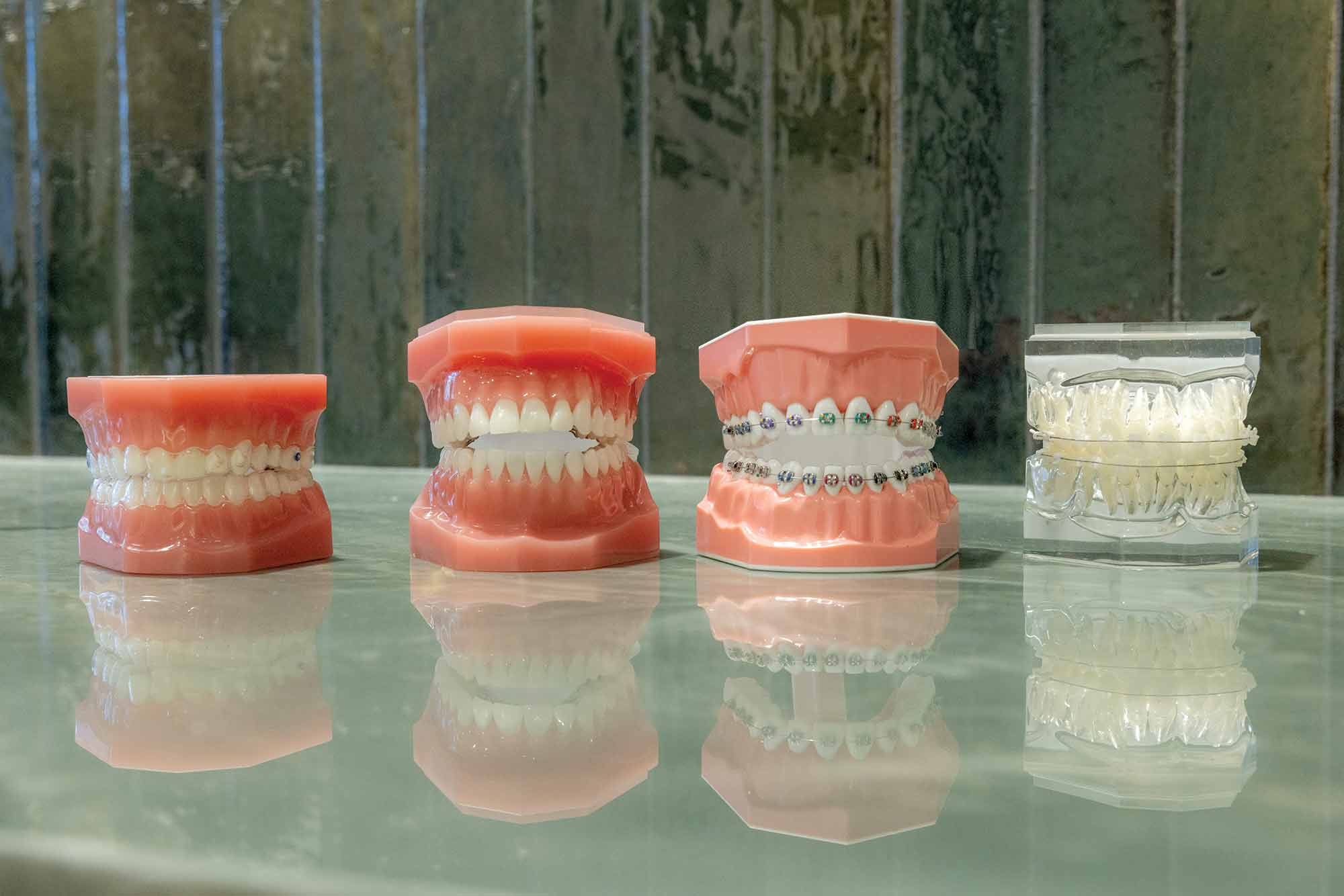 Dental Braces
