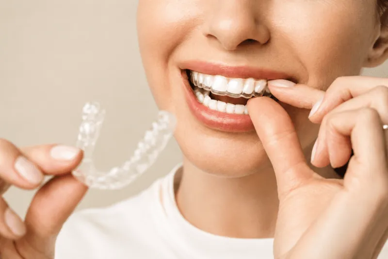 Aligner Insert