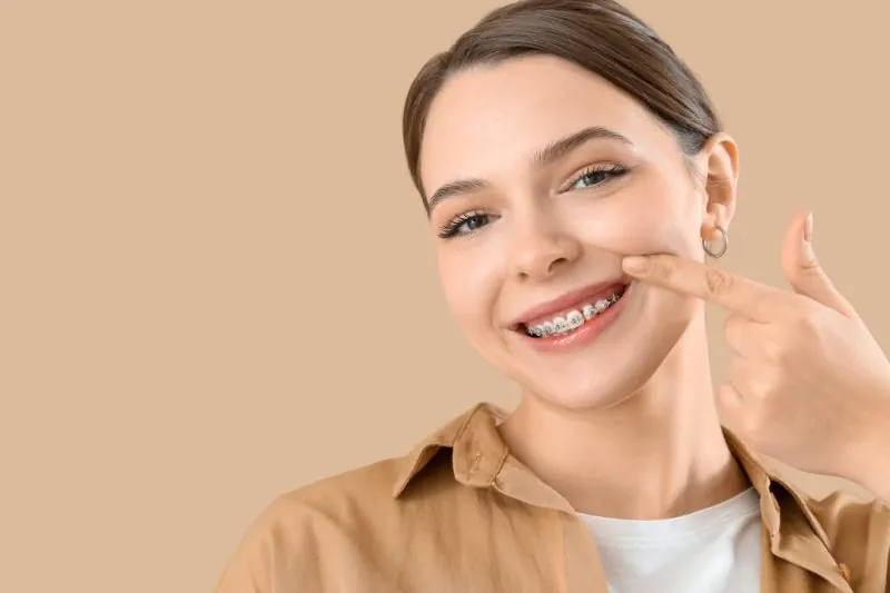 Dental Braces