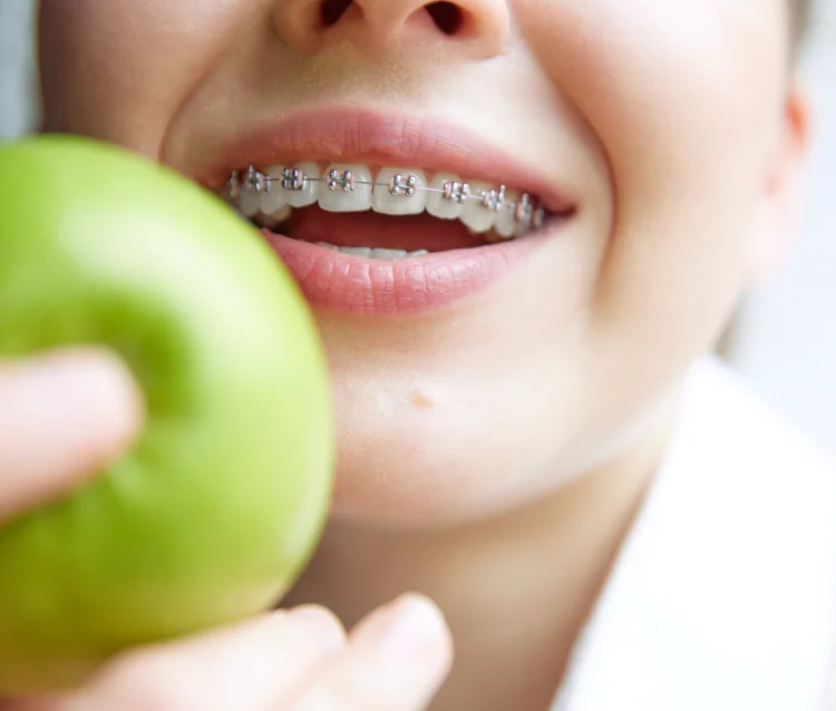 Young patient with ceramic braces smiling